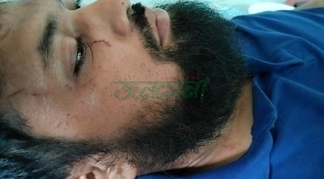 আহত তাজরুল ইসলাম